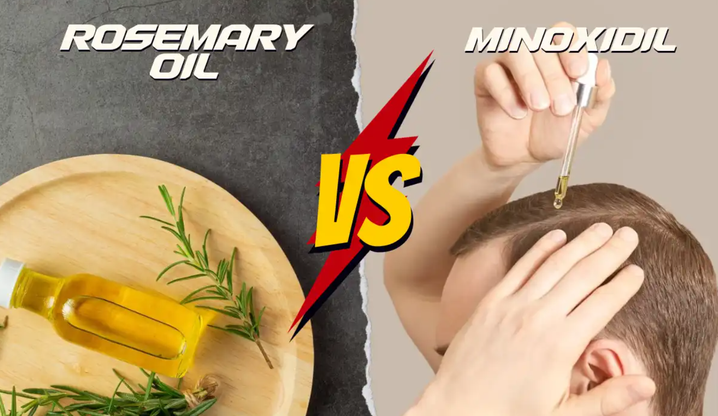 Rosemary Oil vs Minoxidil