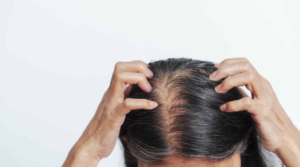 Trichologist Phoenix Hair Loss Expert Arizona